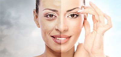 Result-filling-wrinkles-Tunisia